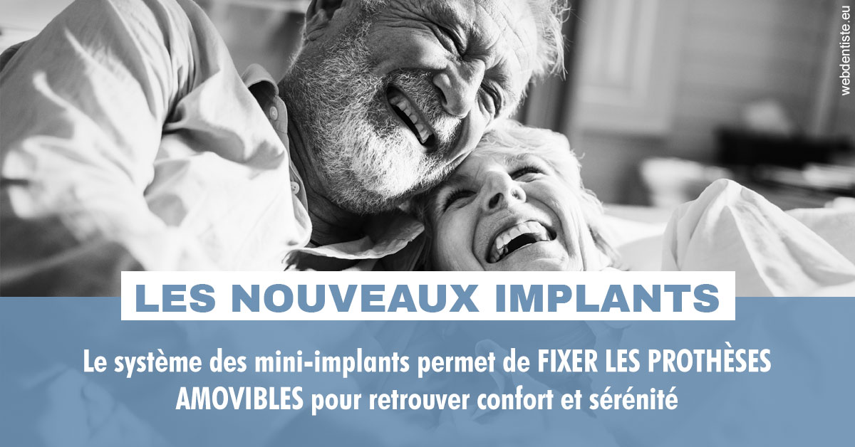 https://dr-justin-laurence.chirurgiens-dentistes.fr/Les nouveaux implants 2