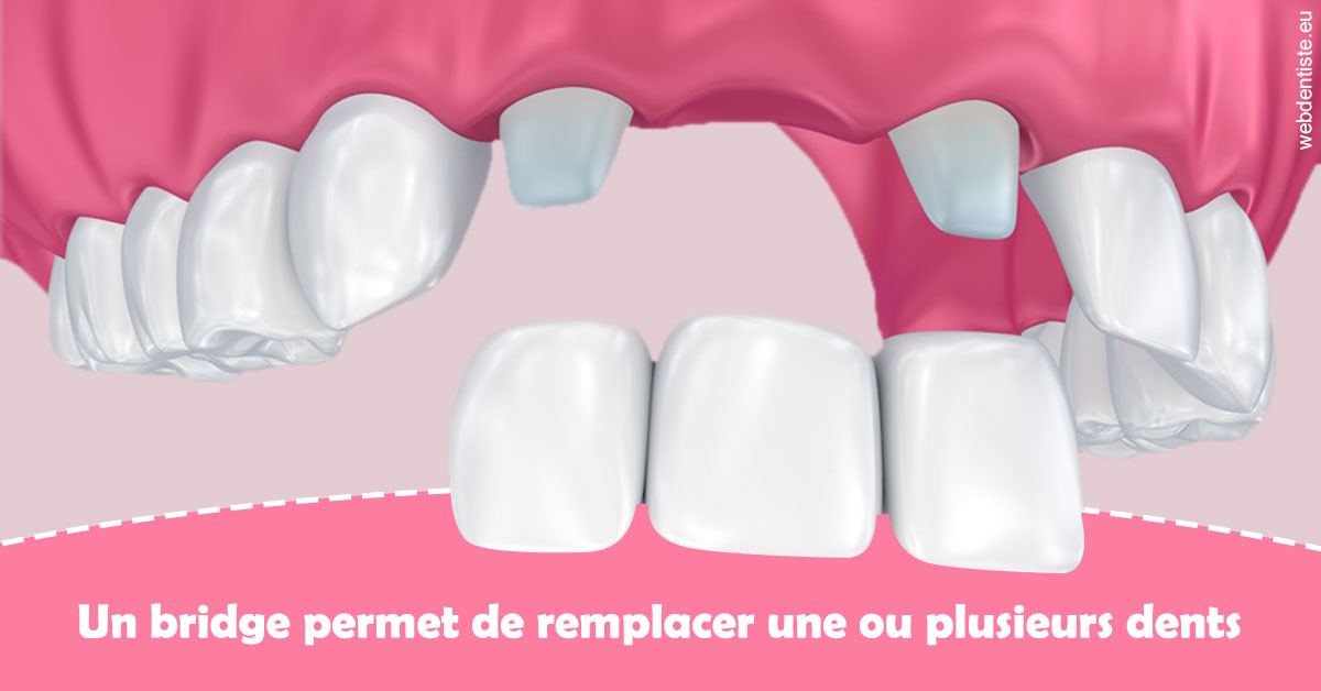 https://dr-justin-laurence.chirurgiens-dentistes.fr/Bridge remplacer dents 2