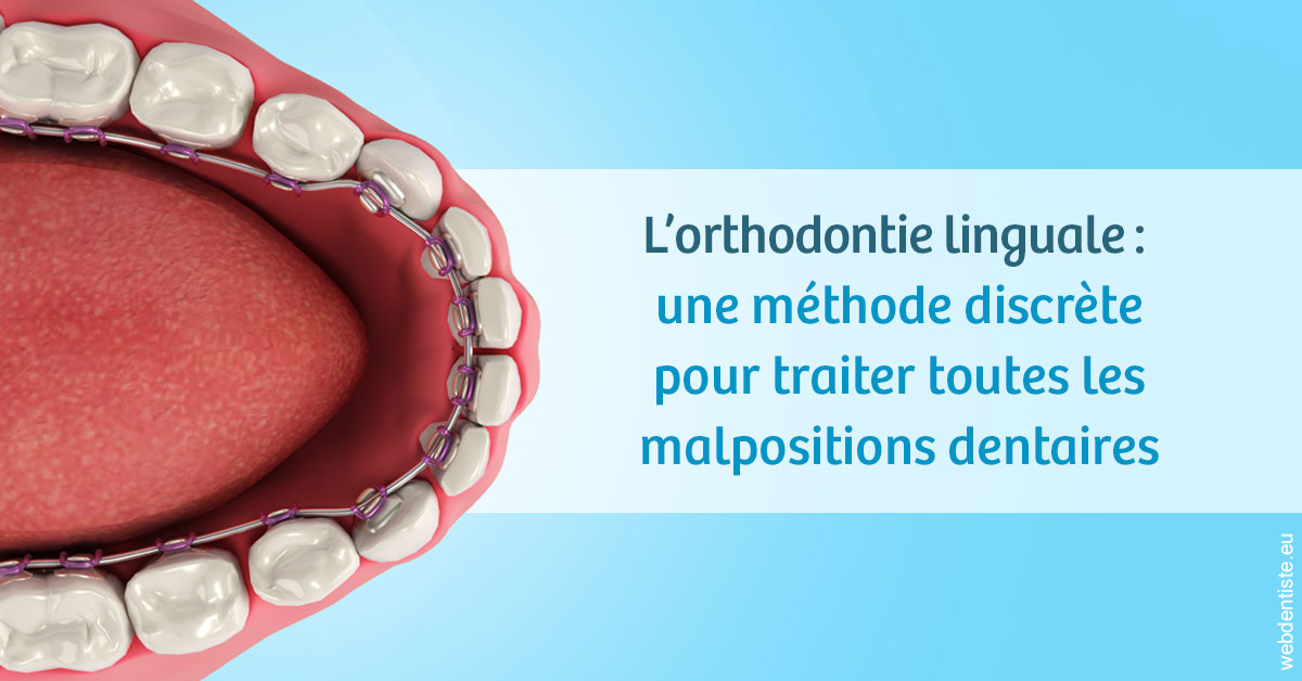 https://dr-justin-laurence.chirurgiens-dentistes.fr/L'orthodontie linguale 1