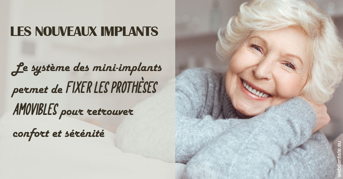 https://dr-justin-laurence.chirurgiens-dentistes.fr/Les nouveaux implants 1