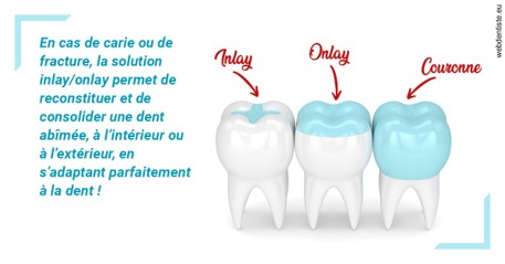 https://dr-justin-laurence.chirurgiens-dentistes.fr/L'INLAY ou l'ONLAY