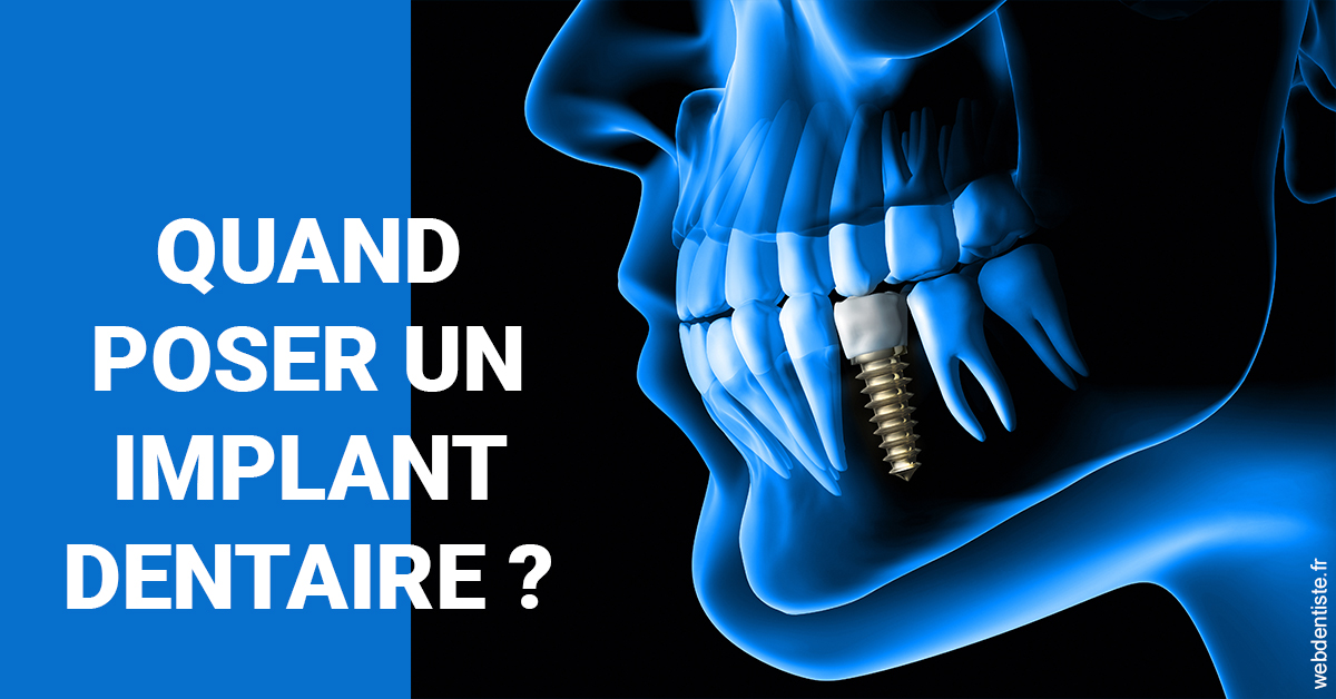 https://dr-justin-laurence.chirurgiens-dentistes.fr/Les implants 1