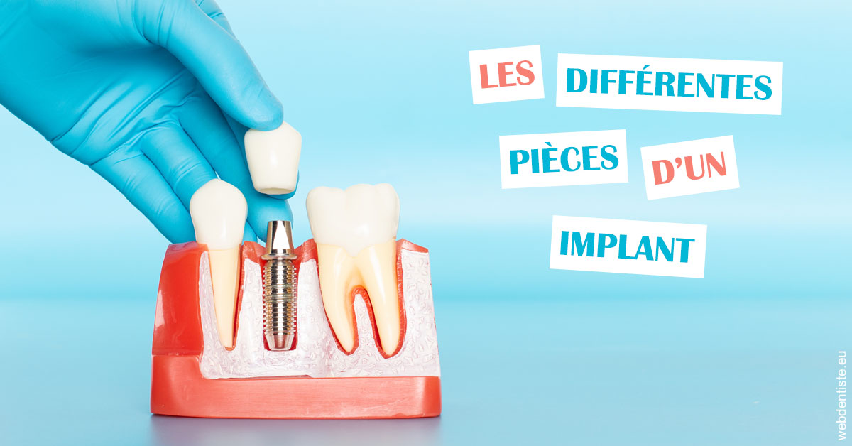 https://dr-justin-laurence.chirurgiens-dentistes.fr/Les différentes pièces d’un implant 2