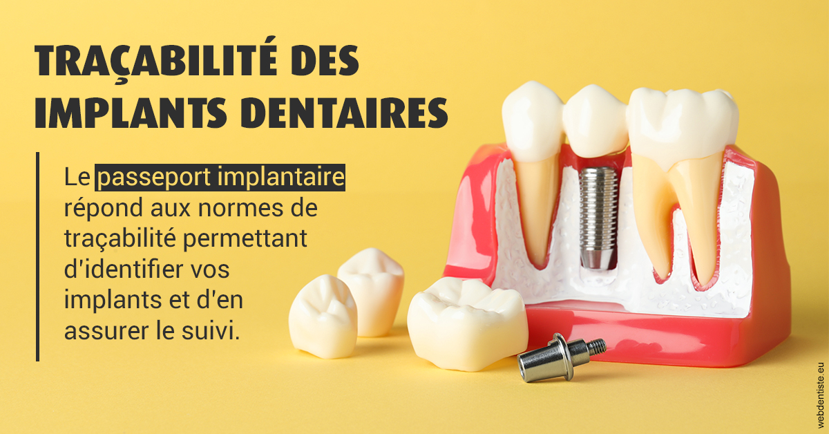 https://dr-justin-laurence.chirurgiens-dentistes.fr/T2 2023 - Traçabilité des implants 2