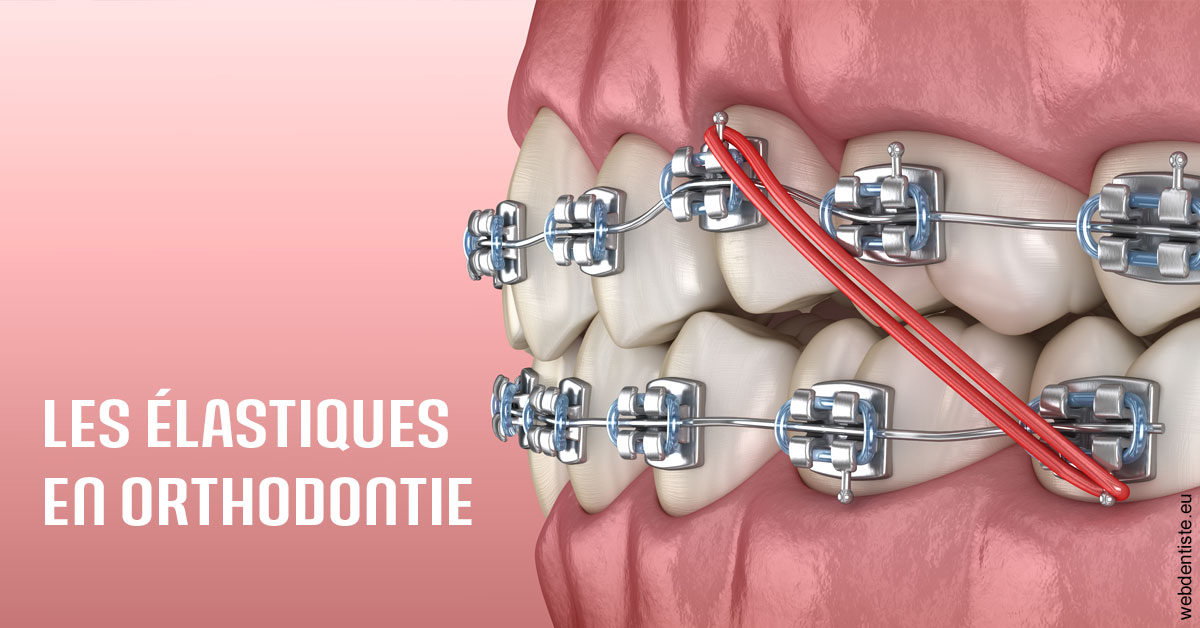 https://dr-justin-laurence.chirurgiens-dentistes.fr/Elastiques orthodontie 2