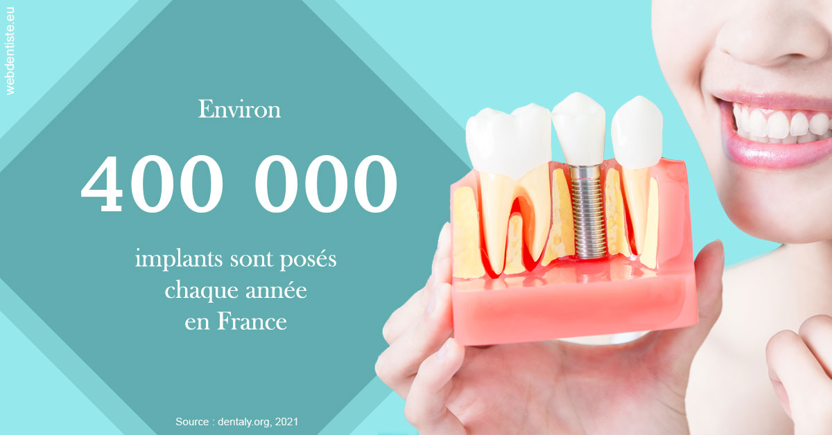 https://dr-justin-laurence.chirurgiens-dentistes.fr/Pose d'implants en France 2